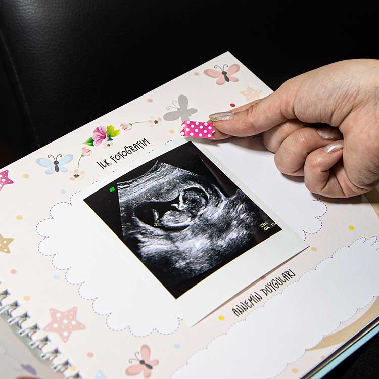 Hamilelik Ve Anne Bebek Günlüğü Mavi - Anı Defteri - 4